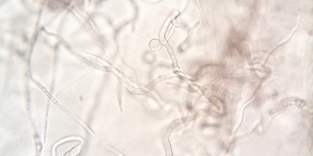 Close-up image depicting the detailed structure of fungal hyphae under a microscope.