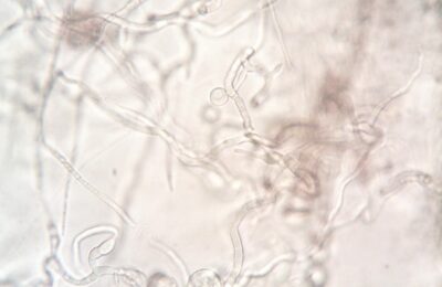 Close-up image depicting the detailed structure of fungal hyphae under a microscope.