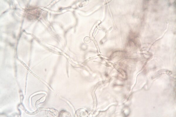 Close-up image depicting the detailed structure of fungal hyphae under a microscope.